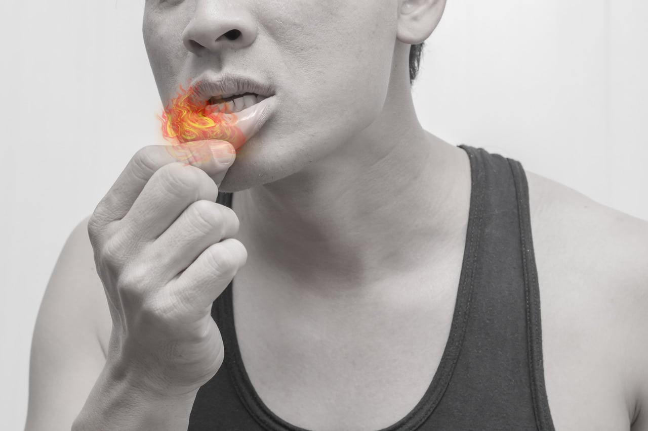 Mouth Ulcers: Varieties, Causes, Prevention and Remedy