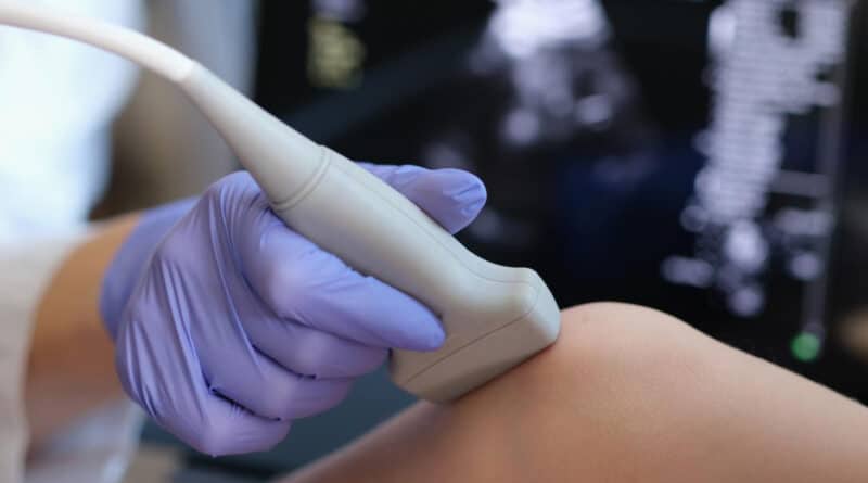 What Therapy Choices Can You Have For Meniscus Tear?