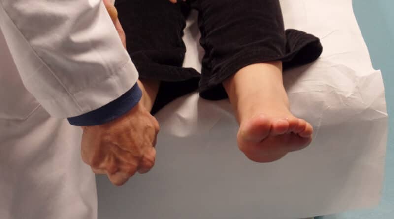 Causes and Therapies for Ankle Discoloration